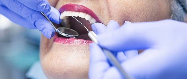 Best Emergency Dental Care for Abscessed Tooth in South Kensington, MD
